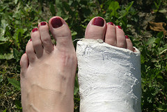 gips gips