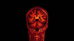 MRI brain scan on Vimeo MRI brain scan on Vimeo